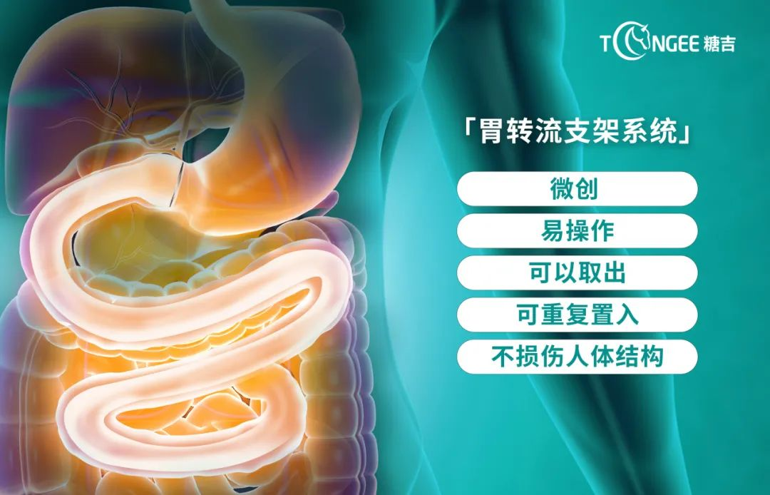 65ae16d3e4b00c772113385f_m.png 65ae16d3e4b00c772113385f_m.png